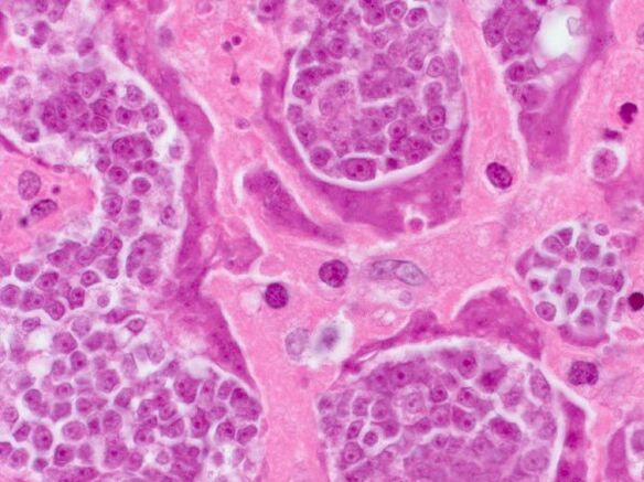 Erforschung von Parasiten in einer Person