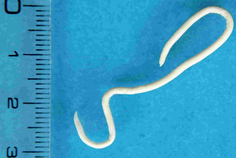 Beschreibung menschlicher Parasiten