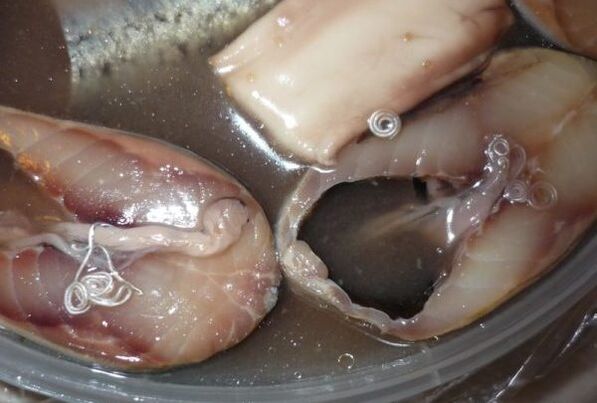 Infektionswege des Menschen durch Parasiten