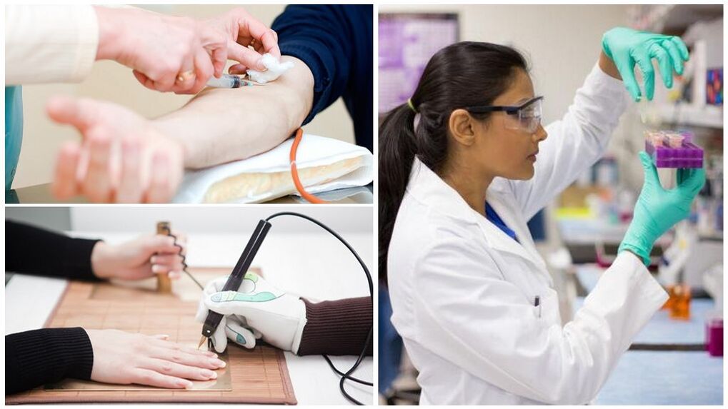 Diagnosemethoden zum Nachweis von Parasiten im Körper