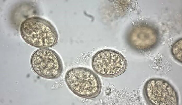 Parasiten unter dem Mikroskop