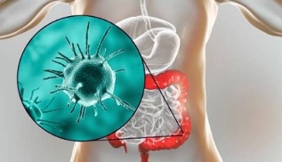 welche Tests für Parasiten zu nehmen