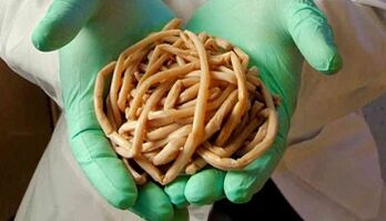 Methoden zur Beseitigung von Parasiten aus dem Körper